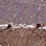PLXDC2 Antibody in Immunohistochemistry (Paraffin) (IHC (P))