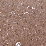 PLXDC2 Antibody in Immunohistochemistry (Paraffin) (IHC (P))