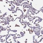 PLXDC2 Antibody in Immunohistochemistry (Paraffin) (IHC (P))