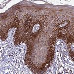 PLXDC2 Antibody in Immunohistochemistry (Paraffin) (IHC (P))