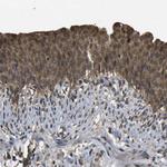 HFE Polyclonal Antibody