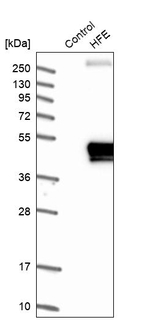 HFE Antibody in Western Blot (WB)