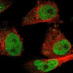 SSB Polyclonal Antibody