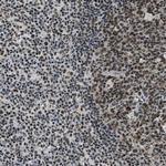 SSB Antibody in Immunohistochemistry (Paraffin) (IHC (P))