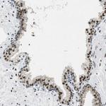SSB Antibody in Immunohistochemistry (Paraffin) (IHC (P))