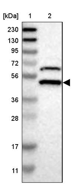 SSB Antibody in Western Blot (WB)