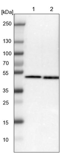 SSB Antibody in Western Blot (WB)