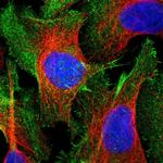 Caldesmon Polyclonal Antibody