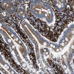Caldesmon Antibody in Immunohistochemistry (Paraffin) (IHC (P))
