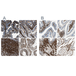 Caldesmon Antibody in Immunohistochemistry (Paraffin) (IHC (P))