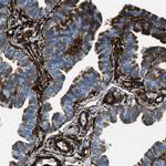 Caldesmon Antibody in Immunohistochemistry (Paraffin) (IHC (P))