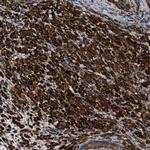 Caldesmon Antibody in Immunohistochemistry (Paraffin) (IHC (P))