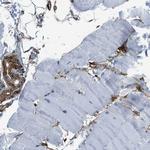 Caldesmon Antibody in Immunohistochemistry (Paraffin) (IHC (P))