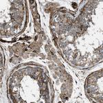 Caldesmon Antibody in Immunohistochemistry (Paraffin) (IHC (P))