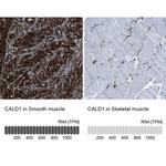 Caldesmon Antibody