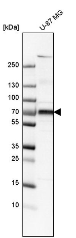 CD73 Antibody in Western Blot (WB)