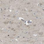 OTUD5 Antibody in Immunohistochemistry (Paraffin) (IHC (P))