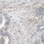 OTUD5 Antibody in Immunohistochemistry (Paraffin) (IHC (P))