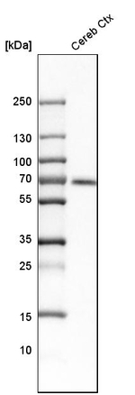 CaMKK beta Antibody in Western Blot (WB)