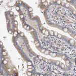MGAT1 Antibody in Immunohistochemistry (Paraffin) (IHC (P))