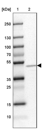 MGAT1 Antibody in Western Blot (WB)