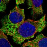 ABCF1 Polyclonal Antibody