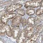 ABCF1 Antibody in Immunohistochemistry (Paraffin) (IHC (P))