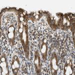 ABCF1 Antibody in Immunohistochemistry (Paraffin) (IHC (P))