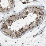 ABCF1 Antibody in Immunohistochemistry (Paraffin) (IHC (P))
