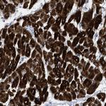 ICA1 Polyclonal Antibody