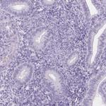 PI3 Antibody in Immunohistochemistry (Paraffin) (IHC (P))