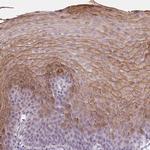 PI3 Polyclonal Antibody