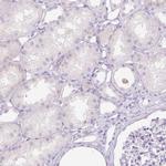 PI3 Antibody in Immunohistochemistry (Paraffin) (IHC (P))