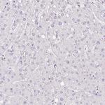 PI3 Antibody in Immunohistochemistry (Paraffin) (IHC (P))
