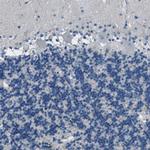 Fibrillin 1 Antibody in Immunohistochemistry (Paraffin) (IHC (P))