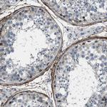 Fibrillin 1 Polyclonal Antibody