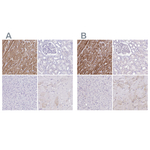 Cardiac Troponin T Polyclonal Antibody