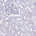 Cardiac Troponin T Antibody in Immunohistochemistry (Paraffin) (IHC (P))