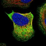 GARS Polyclonal Antibody