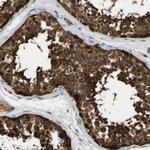 GARS Antibody in Immunohistochemistry (Paraffin) (IHC (P))