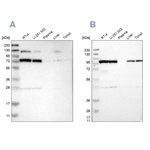 GARS Antibody in Western Blot (WB)