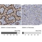 DDX41 Antibody