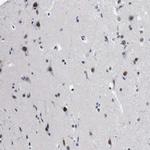 DDX41 Antibody in Immunohistochemistry (Paraffin) (IHC (P))
