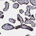 DDX41 Antibody in Immunohistochemistry (Paraffin) (IHC (P))