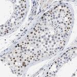 DDX41 Antibody in Immunohistochemistry (Paraffin) (IHC (P))