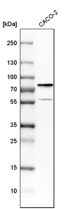 DDX41 Antibody in Western Blot (WB)