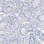 Cytokeratin 1 Polyclonal Antibody