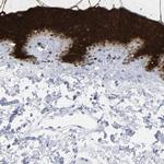 Cytokeratin 1 Antibody in Immunohistochemistry (Paraffin) (IHC (P))