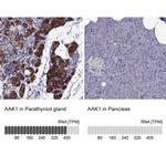 AAK1 Antibody