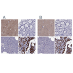 AAK1 Antibody in Immunohistochemistry (Paraffin) (IHC (P))